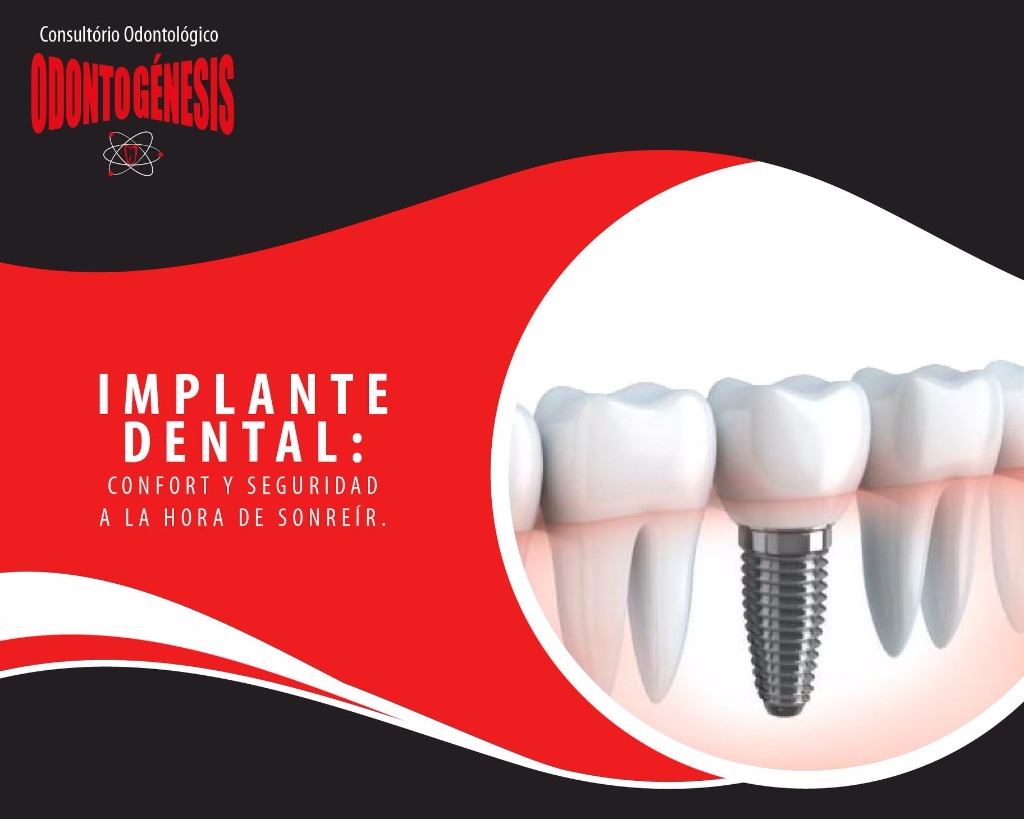 ODONTOGÉNESIS IMPLANTE DENTAL 