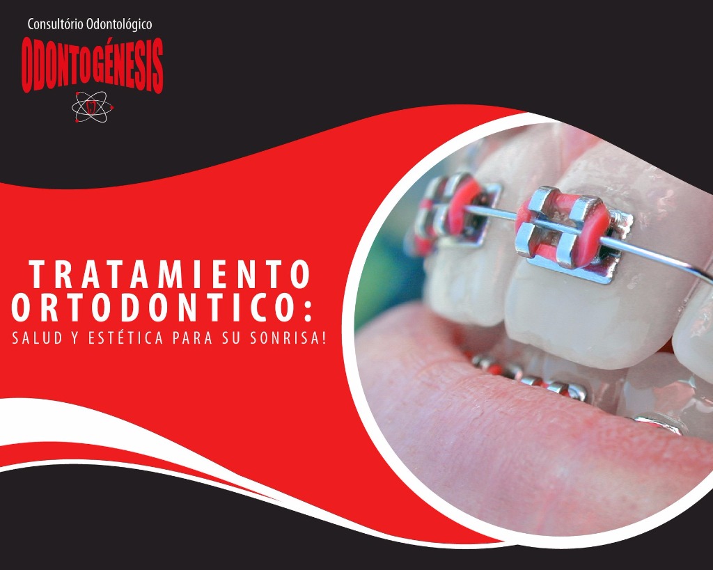 ODONTOGÉNESIS TRATAMIENTO ORTODONTIGO 