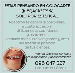 CONSULTORIO DENTAL, ODONTOLOGÍA INTEGRAL DRA CINTIA GOMEZ BRACKETS