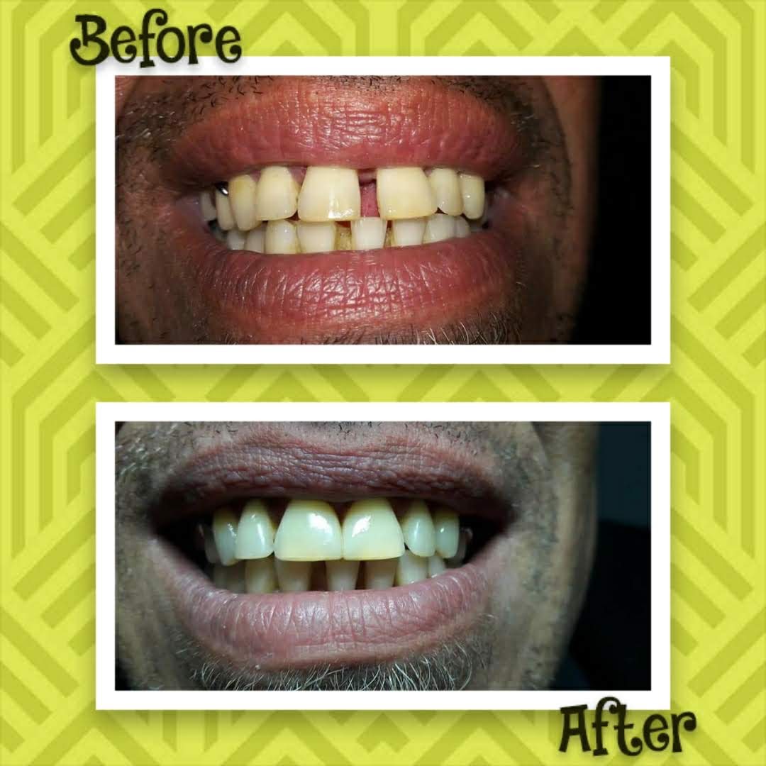 REDESCUBRÍ TU SONRISA  