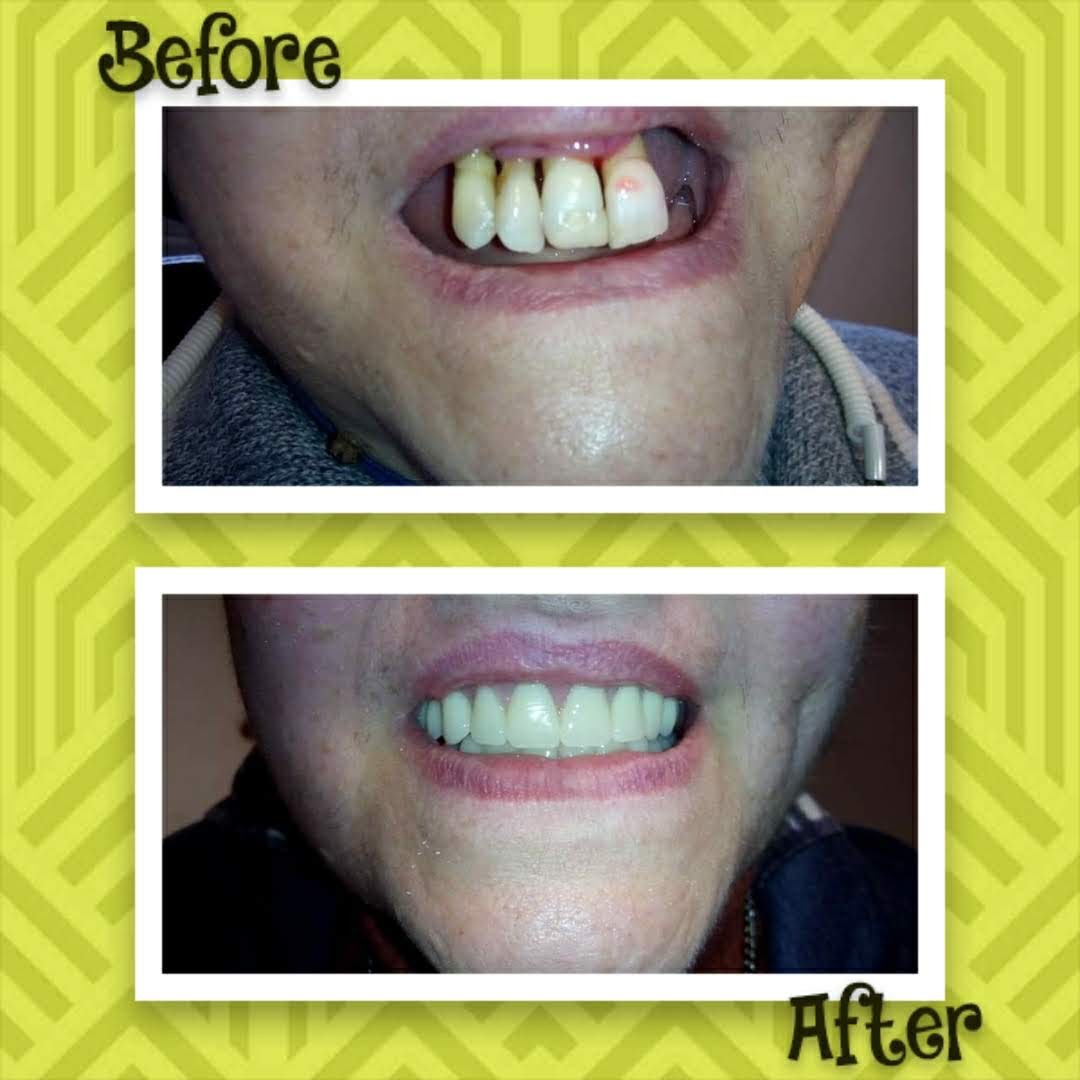 REDESCUBRÍ TU SONRISA  