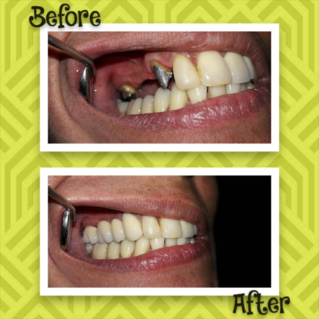 REDESCUBRÍ TU SONRISA  