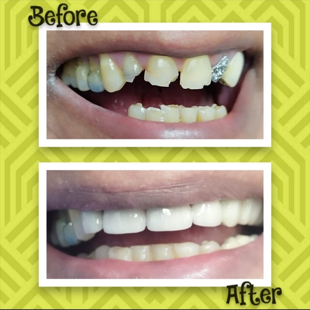 REDESCUBRÍ TU SONRISA  