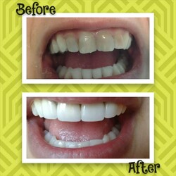 REDESCUBRÍ TU SONRISA 