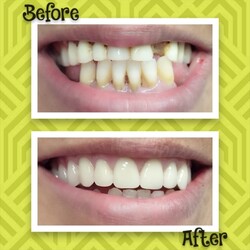 REDESCUBRÍ TU SONRISA 