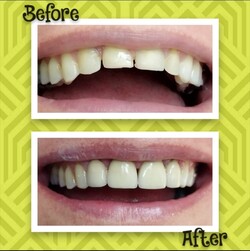 REDESCUBRÍ TU SONRISA 