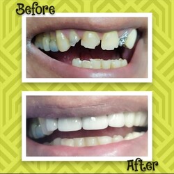 REDESCUBRÍ TU SONRISA 