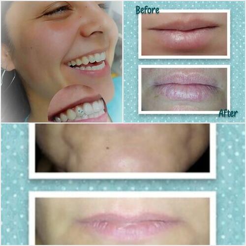 ESTÉTICA  REDESCUBRÍ TU SONRISA