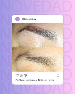 LUDERMIA SALUD Y ESTETICA 