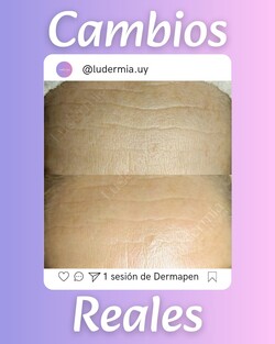 LUDERMIA SALUD Y ESTETICA 