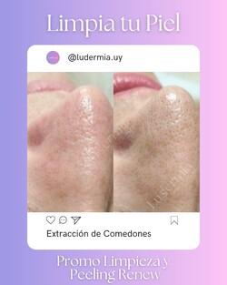 LUDERMIA SALUD Y ESTETICA 