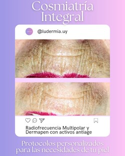 LUDERMIA SALUD Y ESTETICA 