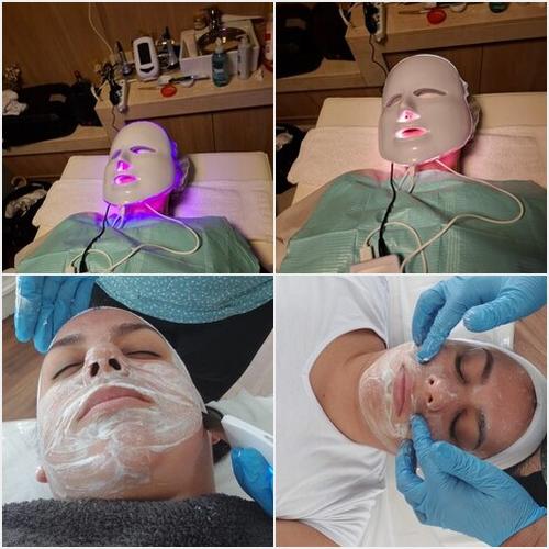 Fototerapia JA JACQUELINE ACOSTA