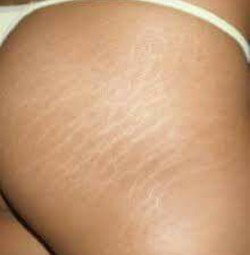 TERAPIAS ALTERNATIVAS SHANTI GIAMA 