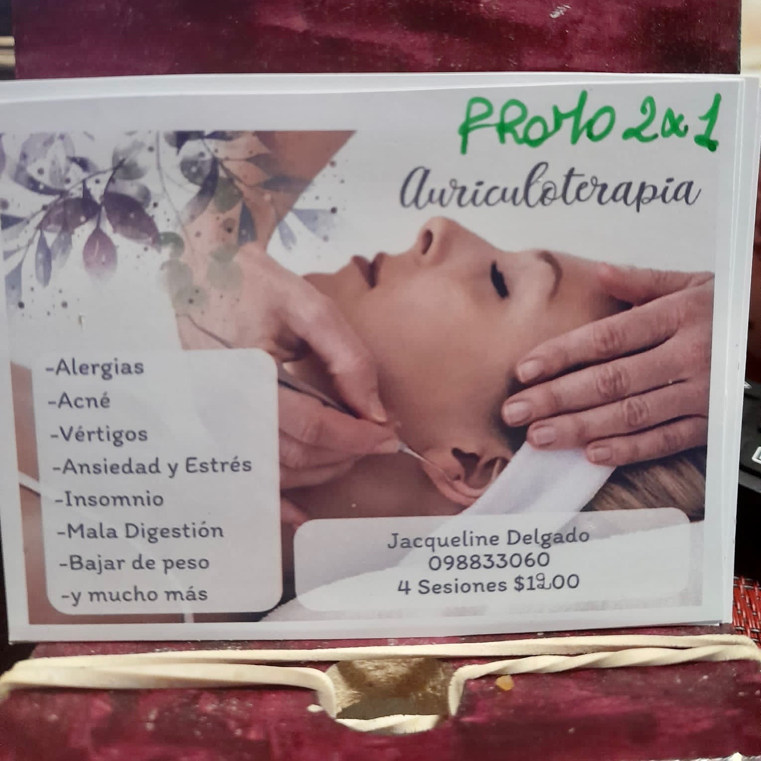 AURICULOTERAPIA HAKELN  