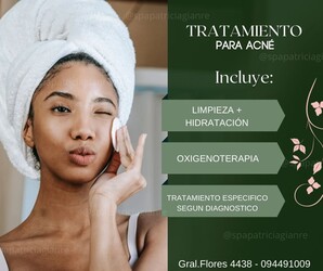 SPA Patricia Gianre Tratamiento para Acné