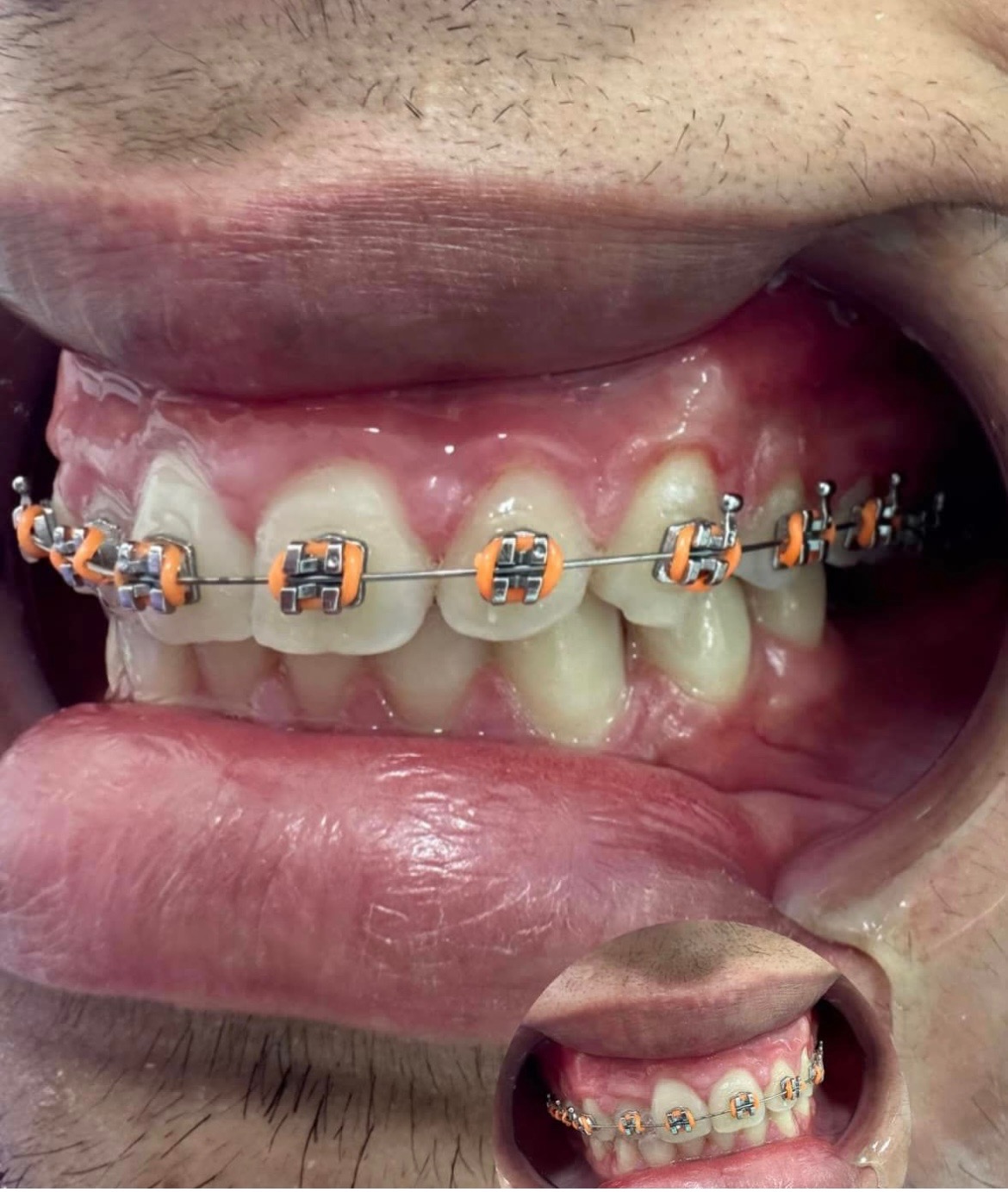 IPORÁ DENTAL Tratamientos de ortodoncia 