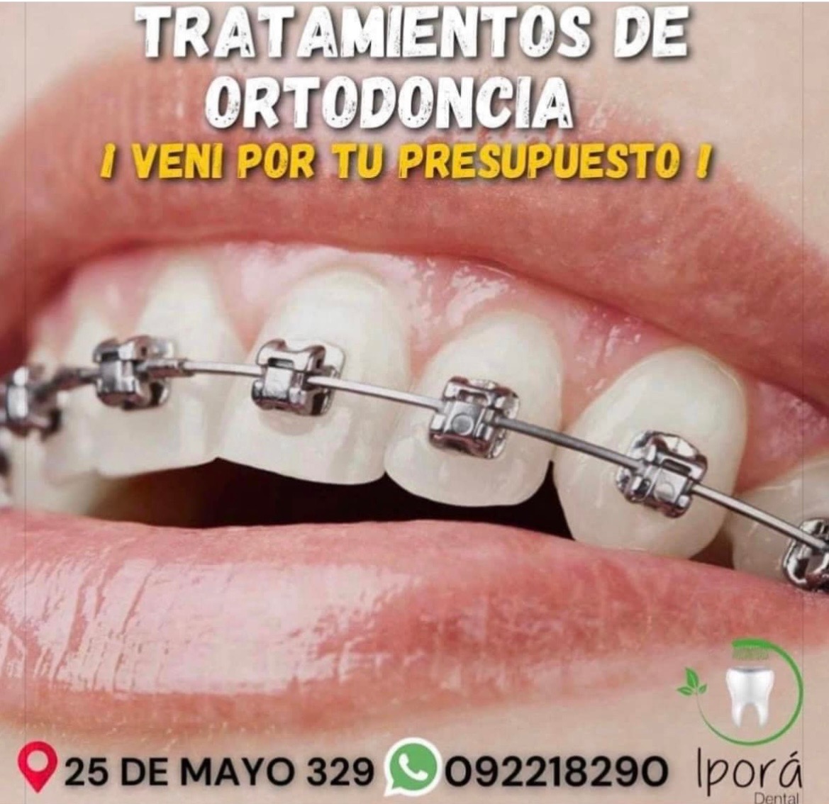 IPORÁ DENTAL Tratamientos de ortodoncia 