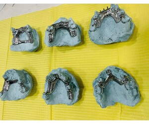 IPORÁ DENTAL Prótesis de cromo superiores e inferiores 