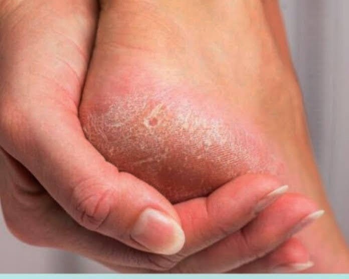 Verónica Villar Tratamiento de pies agretiados Podología y Estética