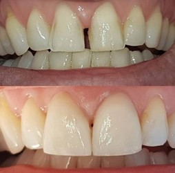 MÁXIMA COBERTURA ODONTOLÓGICA 