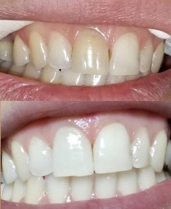 MÁXIMA COBERTURA ODONTOLÓGICA 