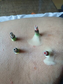 ESTETICA ARACELI GONZALEZ 