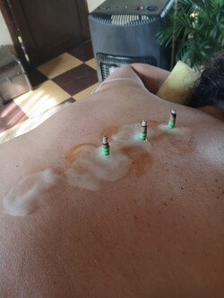 ESTETICA ARACELI GONZALEZ 