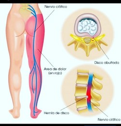 LORENA SEDARRI QUIROPRAXIA 