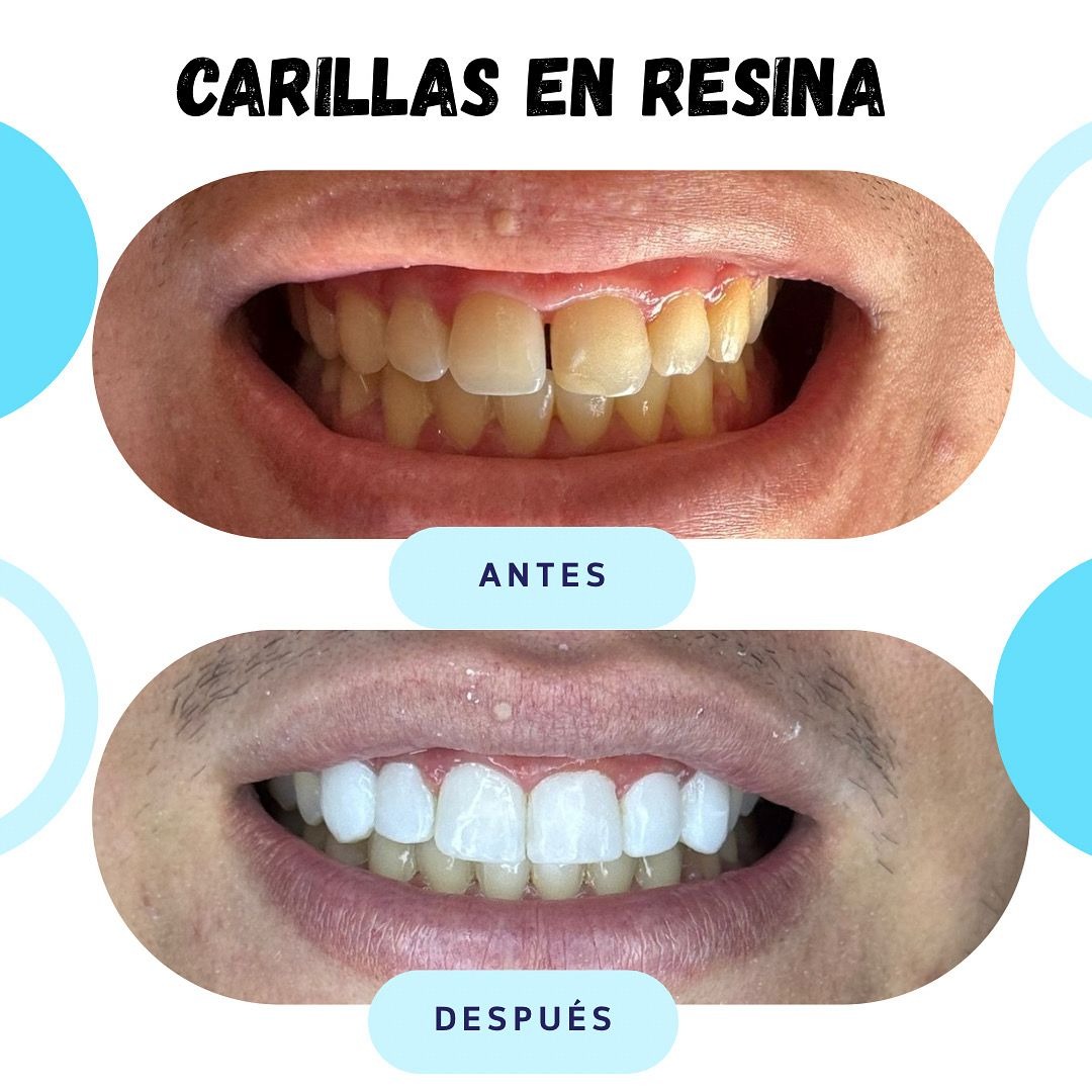 Rios Dent  