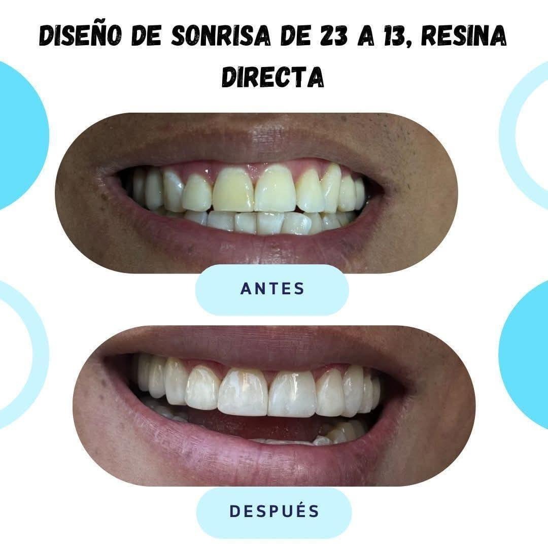 Rios Dent  