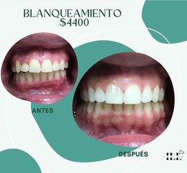 CONSULTORIO ODONTOLOGICO DR.  IGNACIO LLAGUNO 