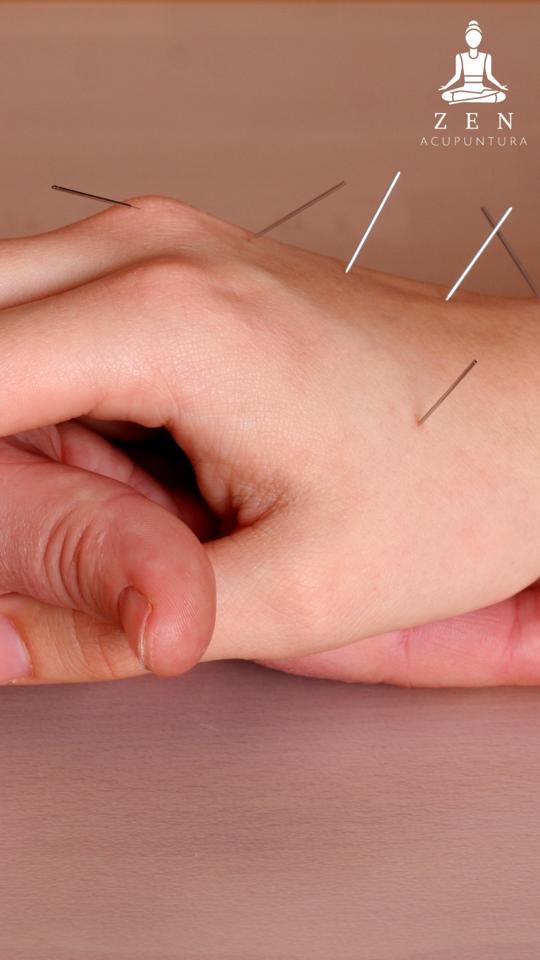 ZEN ACUPUNTURA  