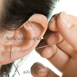 ZEN ACUPUNTURA 