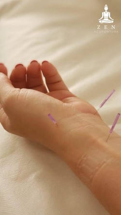ZEN ACUPUNTURA 