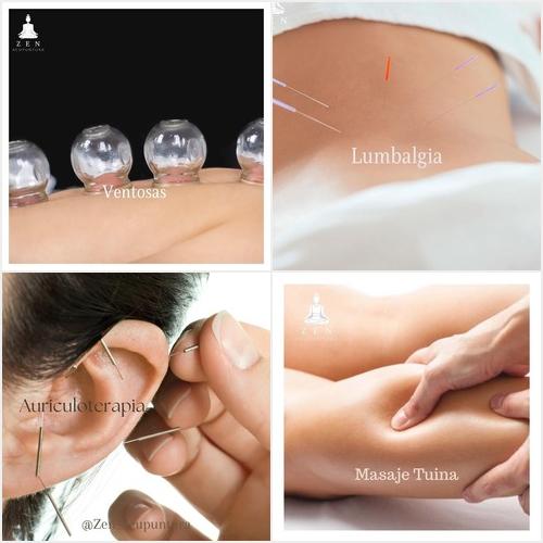 ZEN ACUPUNTURA - Medicina china ZEN ACUPUNTURA
