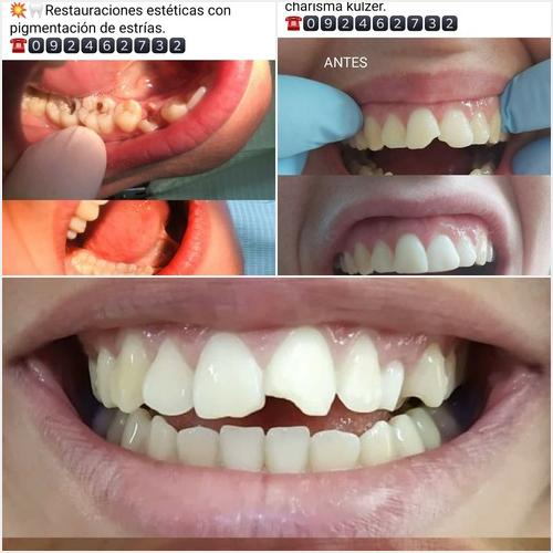 Nuestros trabajos ESPACIO DENTAL