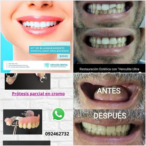 Nuestros trabajos ESPACIO DENTAL