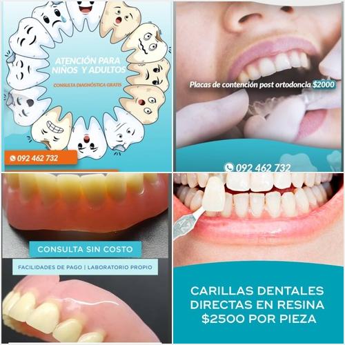 Nuestros trabajos ESPACIO DENTAL