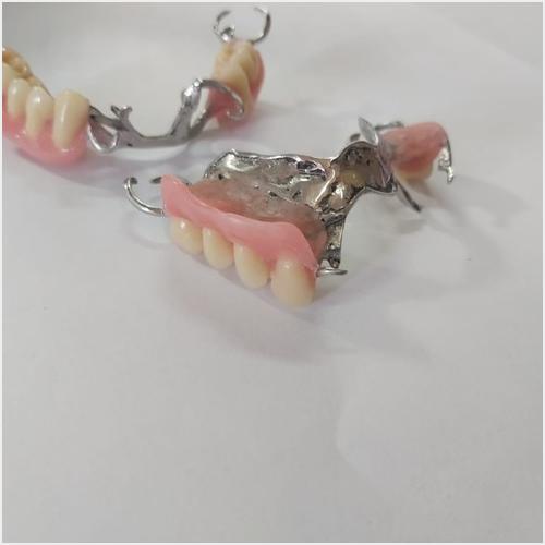 Nuestros trabajos ESPACIO DENTAL
