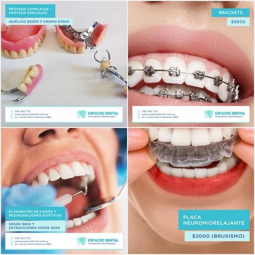 Nuestros trabajos ESPACIO DENTAL