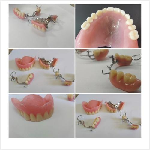 Nuestros trabajos ESPACIO DENTAL