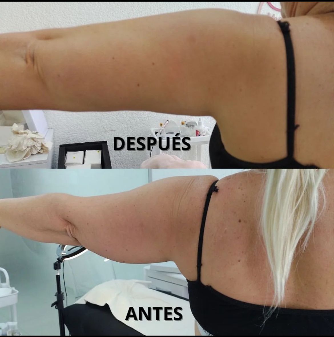 CENTRO ESTETICO INES ALFONSO  