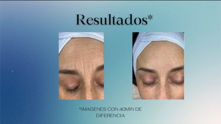 CENTRO ESTETICO INES ALFONSO 