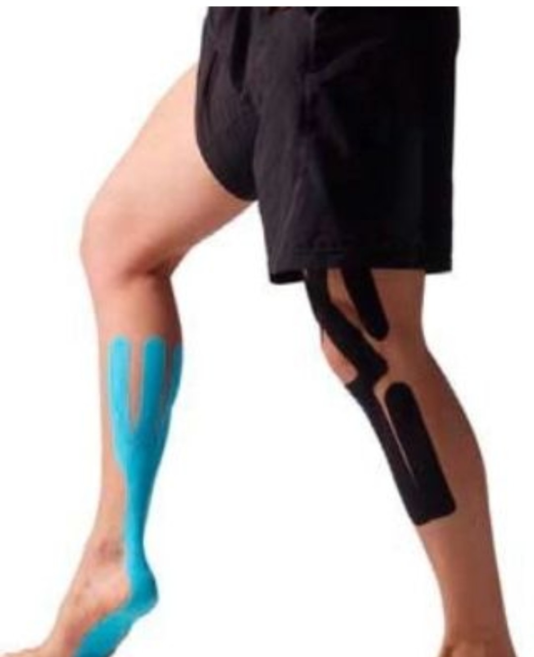 ORTOPEDIA PARMA  BANDAS ELASTICAS