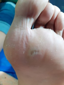 PODÓLOGA RAQUEL CORREA 