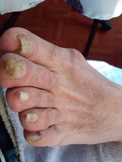 PODÓLOGA RAQUEL CORREA 