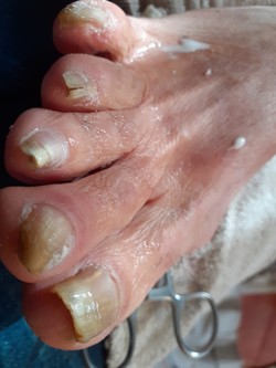 PODÓLOGA RAQUEL CORREA 