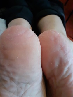 PODÓLOGA RAQUEL CORREA 