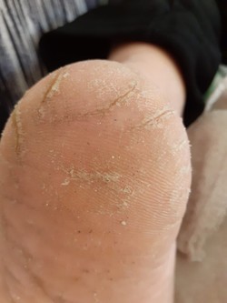 PODÓLOGA RAQUEL CORREA 